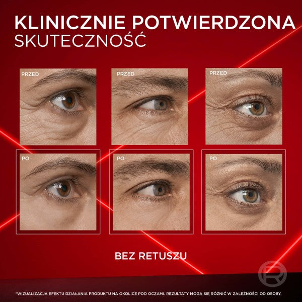 L'Oreal Paris Revitalift Laser Eye Bag Instant Eraser reduktor cieni i worków pod oczami 15ml