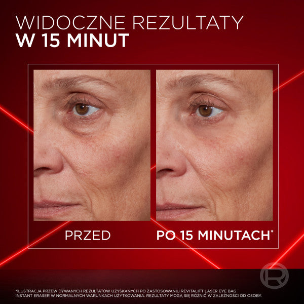 L'Oreal Paris Revitalift Laser Eye Bag Instant Eraser reduktor cieni i worków pod oczami 15ml