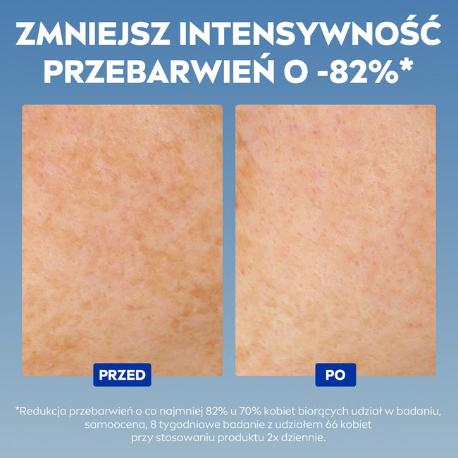Nivea Luminous630® zaawansowane serum na przebarwienia 30ml
