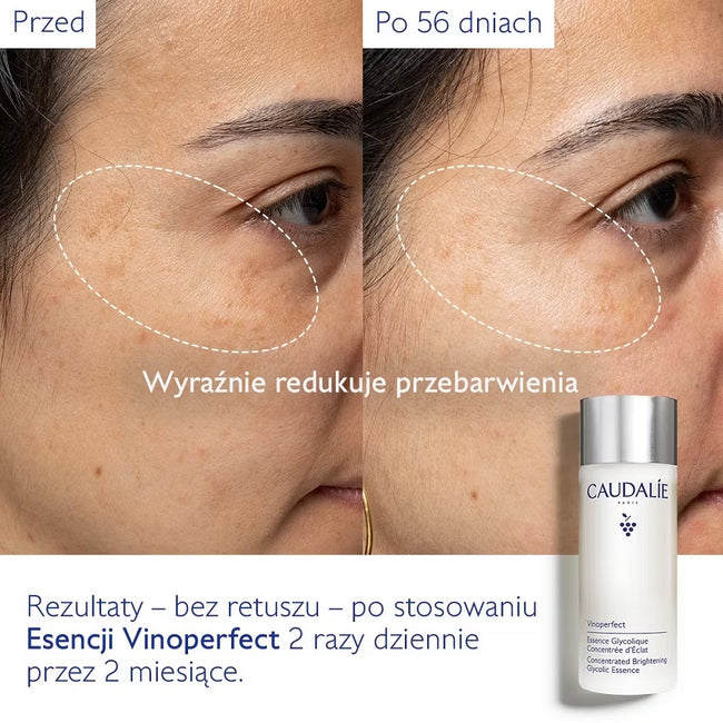 Caudalie Vinoperfect skoncentrowana glikolowa esencja dodająca blasku 100ml