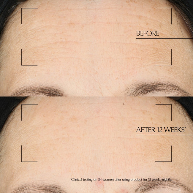 Estée Lauder Advanced Night Repair Overnight Treatment zaawansowana kuracja naprawcza na noc 65ml