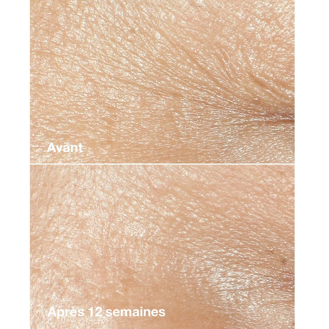 Clinique Smart Clinical Repair™ Wrinkle Correcting Rich Cream bogaty krem korygujący zmarszczki 50ml
