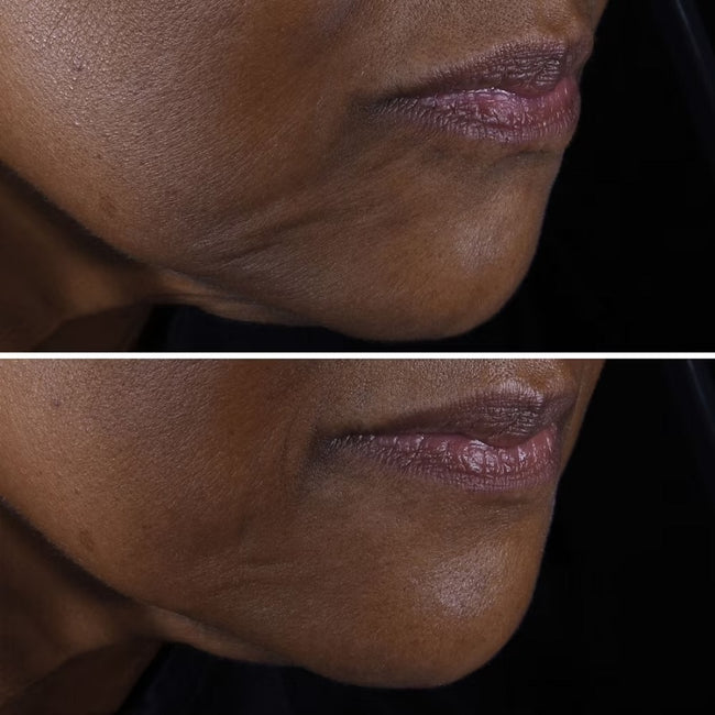 Clinique Smart Clinical Repair™ Lifting Face + Neck Cream liftingujący krem do twarzy i szyi 50ml