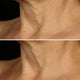 Clinique Smart Clinical Repair™ Lifting Face + Neck Cream liftingujący krem do twarzy i szyi 50ml